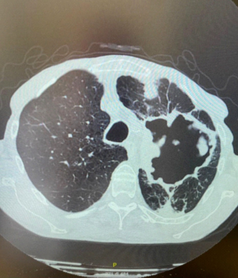Fig. 2